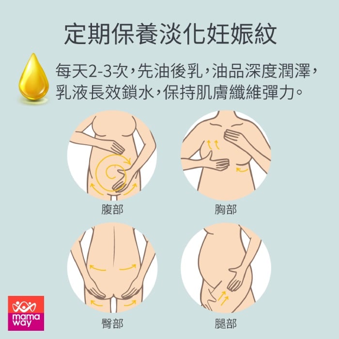 妊娠紋消除方法